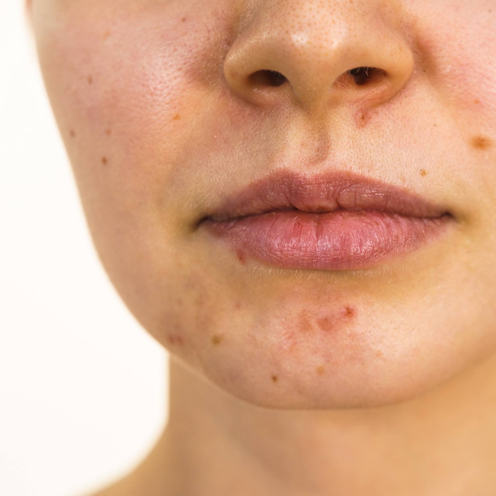 5 conseils naturels pour lutter contre les effets du masque sur la peau ? - Dado Cosmetics
