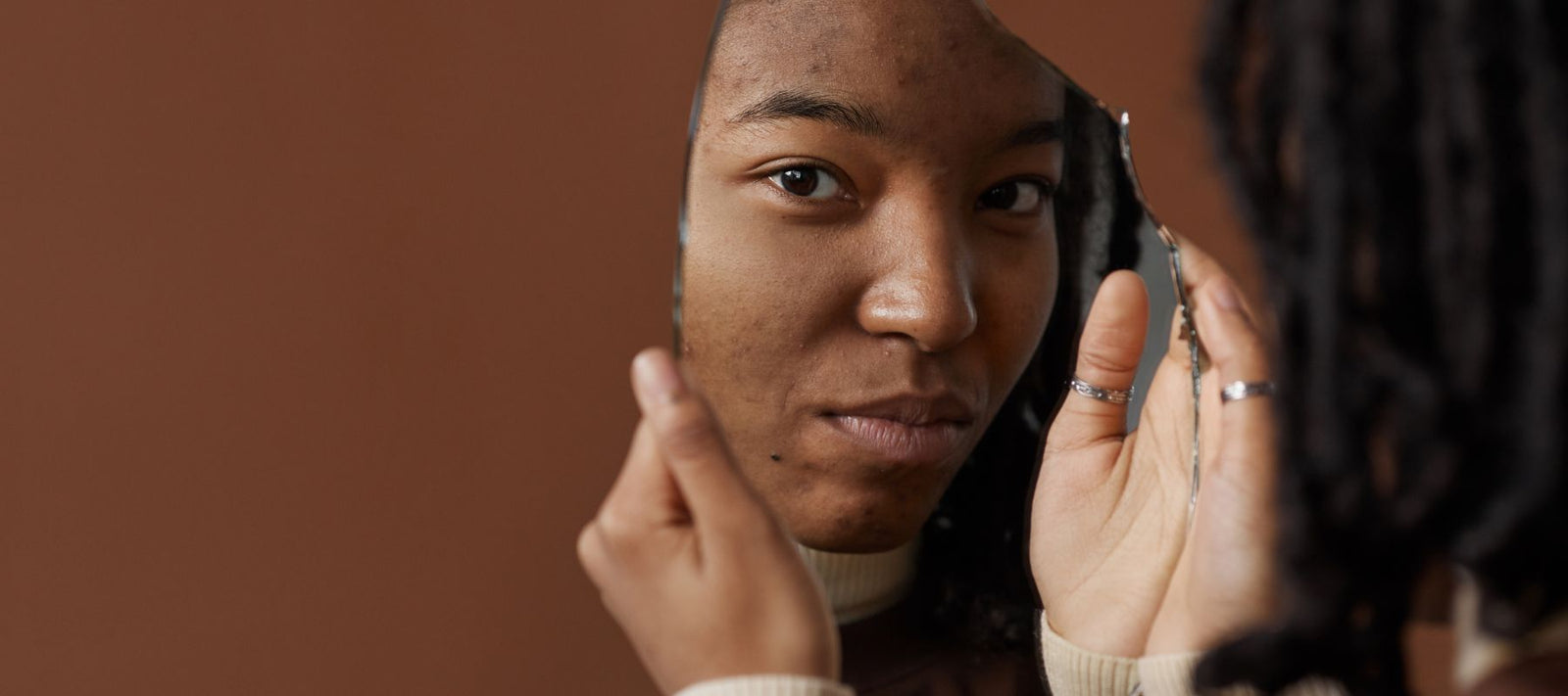 5 solutions naturelles pour atténuer les taches pigmentaires - Dado Cosmetics