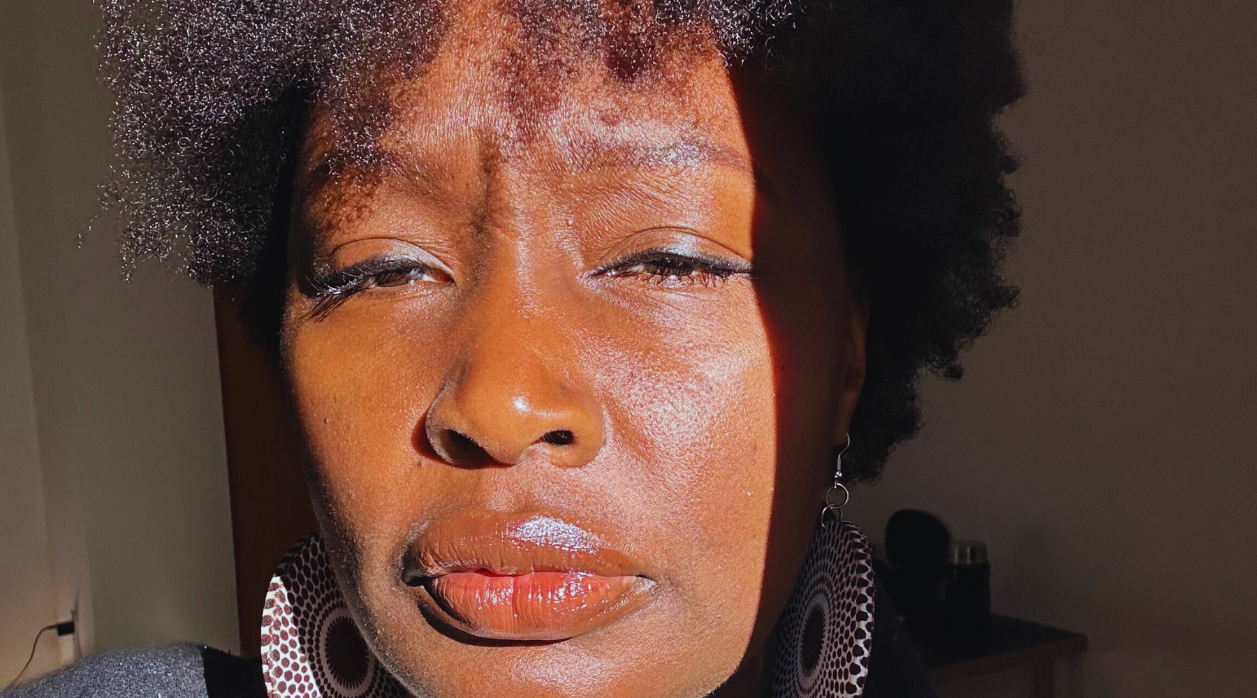 Perturbateurs endocriniens : Ce que j'aurais voulu savoir avant ma réaction allergique